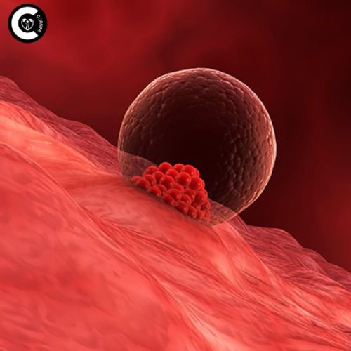 Illustration of fertilized egg implanting in uterus