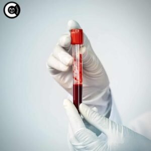 a woman reviewing an AMH blood test result alongside ovarian follicles and hormone molecules