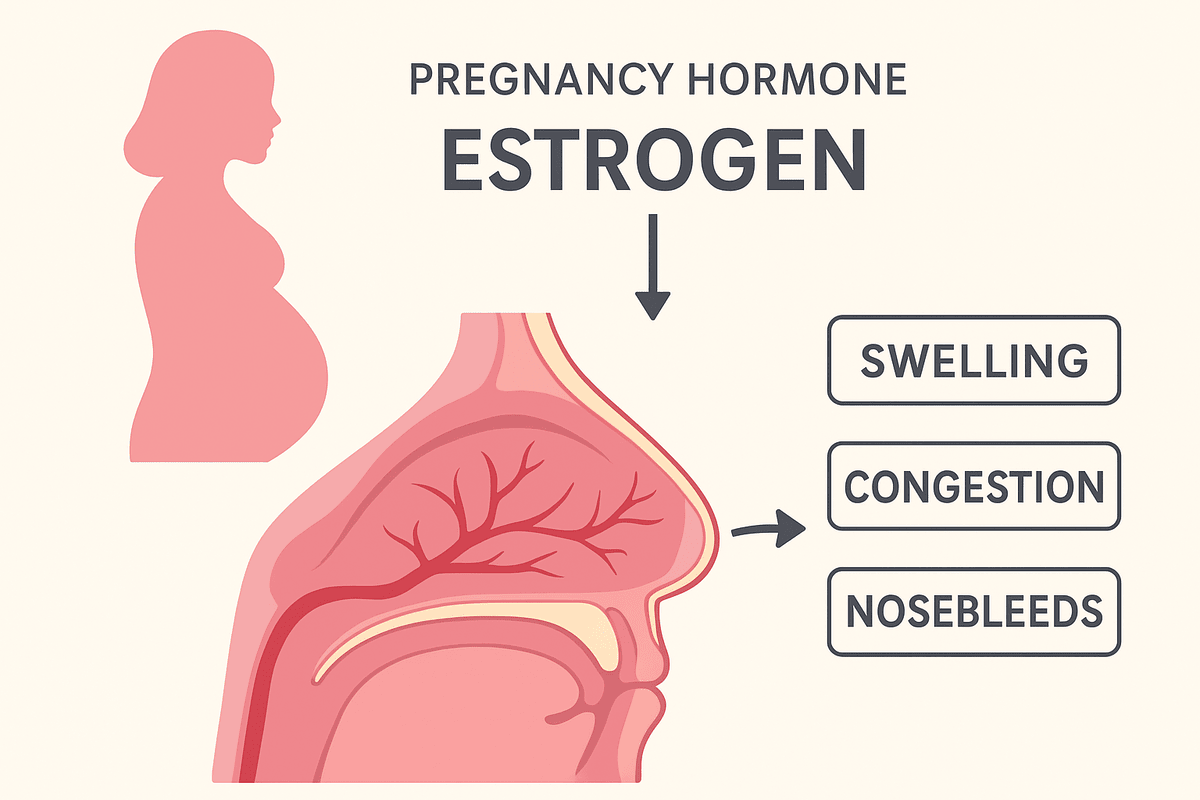 Diagram showing how pregnancy hormones like estrogen increase blood flow to nasal membranes, causing swelling, congestion, and nosebleeds.